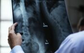 Lielo pilsētu asociācija ar veselības ministri pārrunā reģionālo slimnīcu darbību Lielo pilsētu asociācija ar veselības ministri pārrunā reģionālo slimnīcu darbību